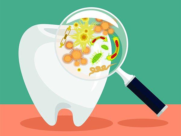 2. Plak birikmesi ve tartar oluşumu diş hekimi tarafından tedavi edilmezse diş çürümesine yol açacaktır.