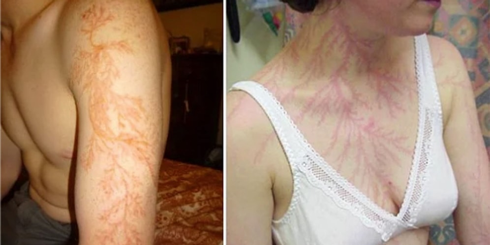 Okurken Size "Yok Artık!" Dedirtecek, Doğru Olduklarına İnanmakta Zorlanacağınız 15 Gerçek!