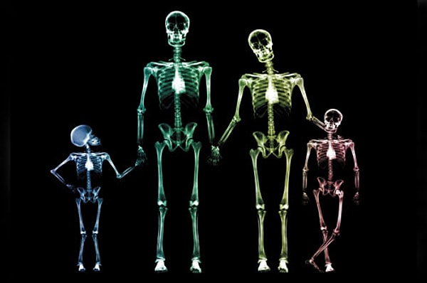 5. Как называется смещение соприкасающихся в полости сустава костей?