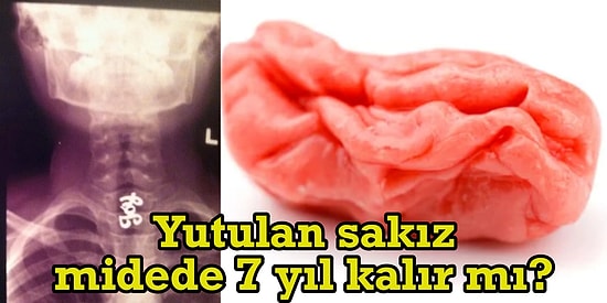 "Midende Sakız Ağacı Çıkacak!" Uzmanlara Göre Çiğnediğiniz Sakızı Yuttuğunuz An Olabilecekler