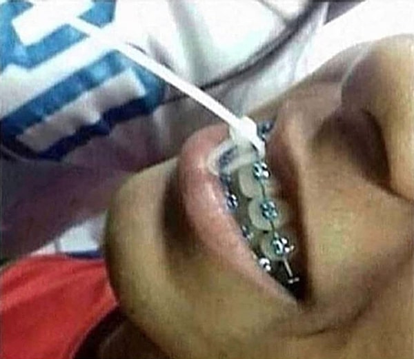 17. "Хватит болтать!"