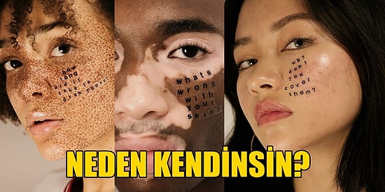 Bizi İncitemezler! Şekilci İnsanların Saldırgan Yorumlarını Mücadelelerinin Zırhı Haline Getiren 9 Cesur Kişi!