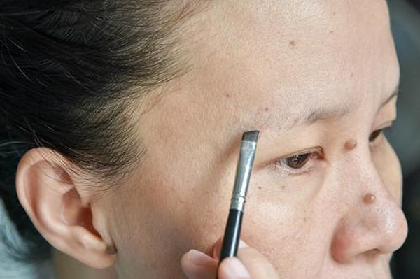 3. Залысины на бровях