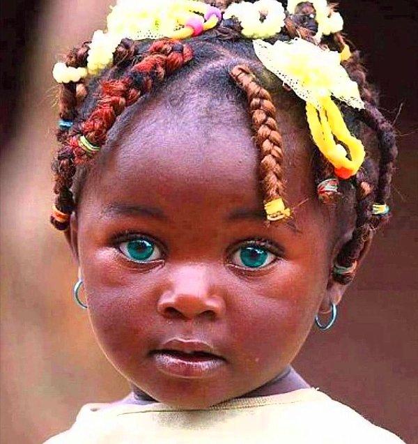 7. "Harika göz rengine sahip bir Afrikalı kız çocuğu."