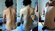 Omurga Ağrılarına Balyozla Vurarak Tedavi Yöntemi Uygulayan Doktor