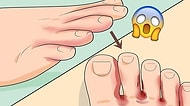 Ayakların Seni Uyarıyor! Ayakların Sağlık Sorunları Hakkında Verdiği 11 Önemli İşaret