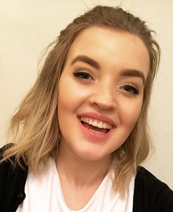 Alt dişleri, üst dişlerine göre daha ileride olduğu için türlü zorbalığa maruz kalan 23 yaşındaki Rebecca Hamilton ile tanışın.