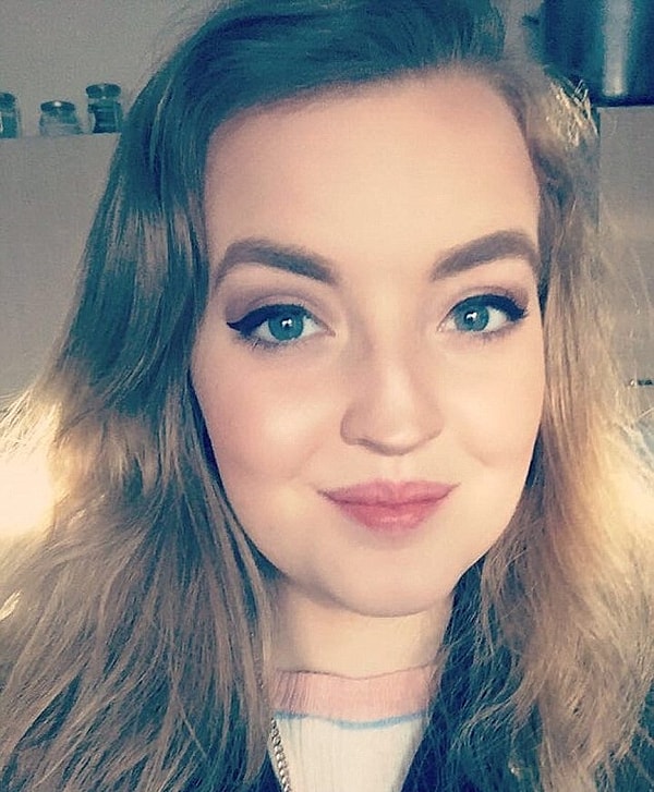 А тем, у кого похожая ситуация, Ребекка советует либо принять свою уникальность и гордиться ею, либо решиться на пластическую операцию, если позволяют финансы