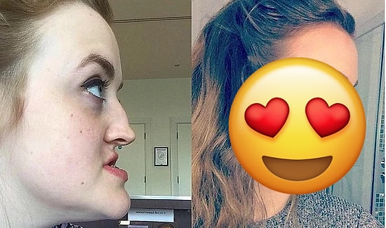 Люди обзывали ее питбулем из-за необычного строения нижней челюсти и щелей между зубами, но вы только посмотрите, как она выглядит сейчас!