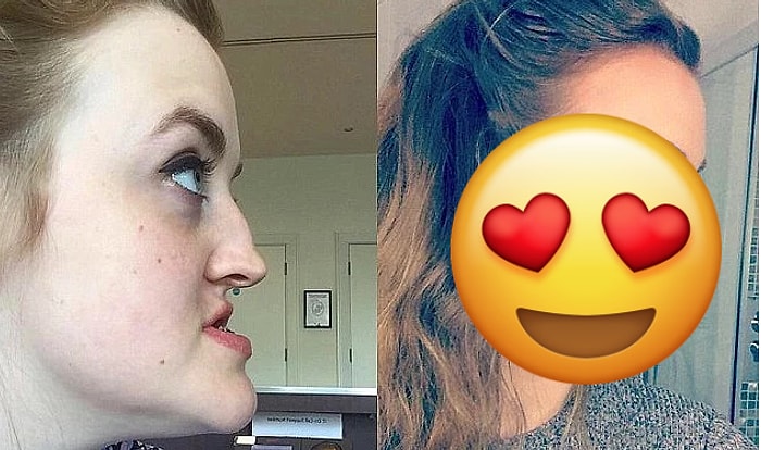 Люди обзывали ее питбулем из-за необычного строения нижней челюсти и щелей между зубами, но вы только посмотрите, как она выглядит сейчас!