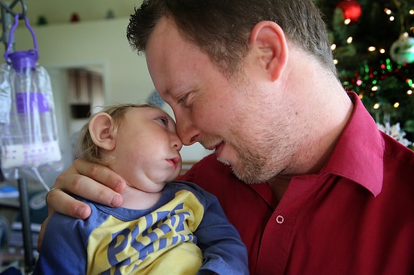 6. Но на 17-й неделе беременности врачи сказали им, что у плода неправильно развивается мозг, и это сводит все надежды на полноценную жизнь ребенка к минимуму.