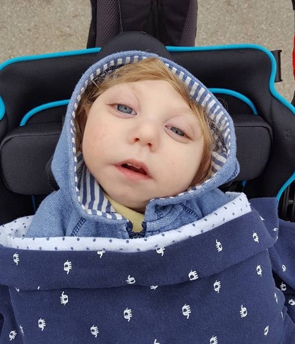 11. История ребенка, который смог выжить без 80% мозга, стала ужасно популярной, и родители необычного малыша получили много поддержки даже от совершенно незнакомых им людей.