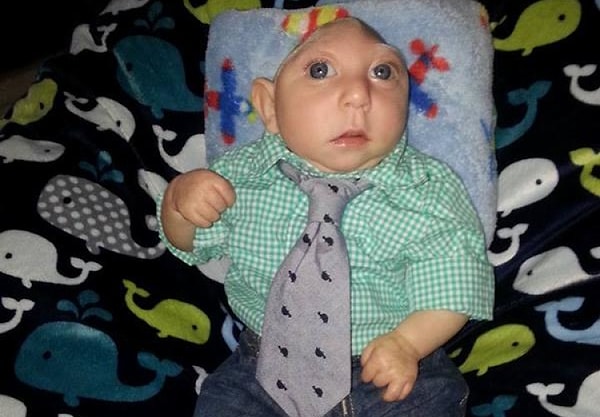 13. Надеемся, что у маленького Джексона все будет хорошо, ведь он настоящий борец 💪