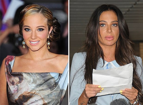 Пластика или увеличение губ!