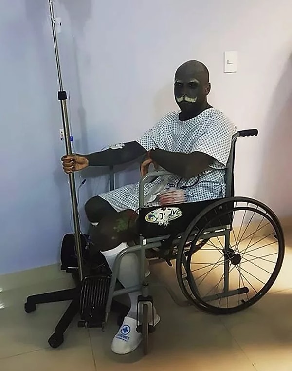 8. «Я всегда чувствовал, что выделяюсь из толпы. Мой любимый цвет — серый, все его оттенки. Моя кожа теперь цвета графита», — рассказывает Адам.