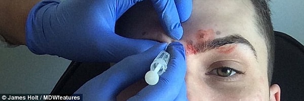 В общем, "перегибает палку" - это мягко сказано. Молодому человеку, кажется, пора обращаться к хорошему психологу, а не к хирургу.