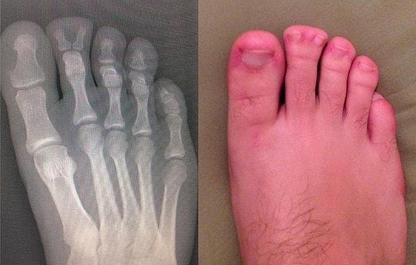 2. "Bu adam tam tamına 22 yıldır ayağının röntgenini görmeyi hayal ediyordu."