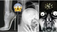 Tuhaflıklarını Görünce Küçük Dilinizi Yutma Noktasına Geleceğiniz 19 Garip Röntgen Filmi
