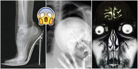 Tuhaflıklarını Görünce Küçük Dilinizi Yutma Noktasına Geleceğiniz 19 Garip Röntgen Filmi