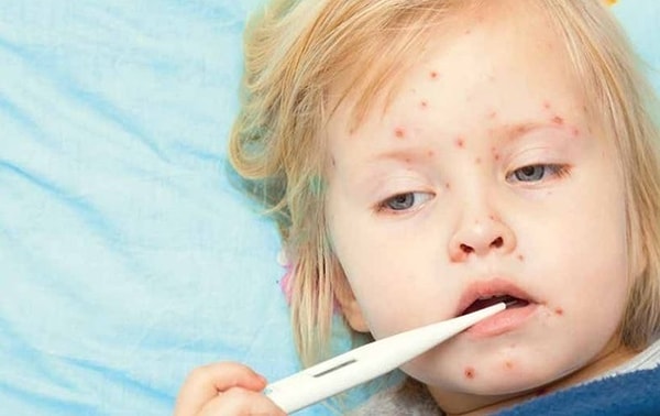 5. Во Франции, Грузии, Греции, Италии, Сербии и России приблизительно по тысяче больных.