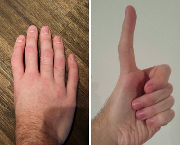 3. "Вот так выглядит моя левая рука"