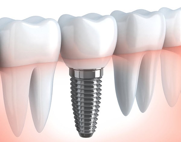 9. Как правильно пишется название вживляемого материала?