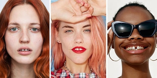 Стесняетесь щербинки? Гляньте на всемирно известных моделей, которые сделали ее своей изюминкой