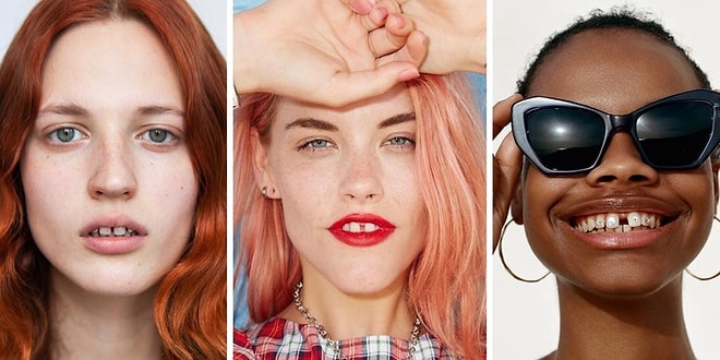 Стесняетесь щербинки? Гляньте на всемирно известных моделей, которые сделали ее своей изюминкой