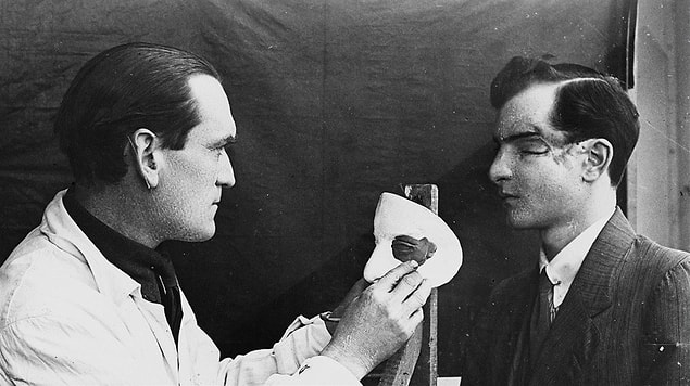 9. Profesör Frantĭsek Burian ve Arnold Jirásek, I. Dünya Savaşı’nda vücudu yanan askerlere yardım etmenin bir yolu olarak plastik cerrahiyi ilk bulan kişilerdir.