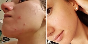 Başlangıçta Her Şey Çok İyiydi! 4 Yıllık Vegan Diyetini Sağlığına Tekrar Kavuşmak İçin Sonlandıran Blog Yazarı