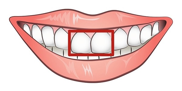 Резцы квадратной формы