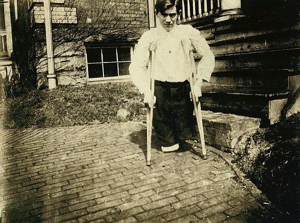 12. 14 yıl 10 aylıkken Batı Virginia'daki bir kömür madenindeki motorlu araba tarafından bacakları koparılan Frank P. Yer: Monongah, West Virginia