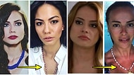 Estetiğin Gücü... Parası Neyse Verip Kendine Yeni Bir Çene Alan 17 Ünlünün Hepinizi Şok Edecek Değişimi