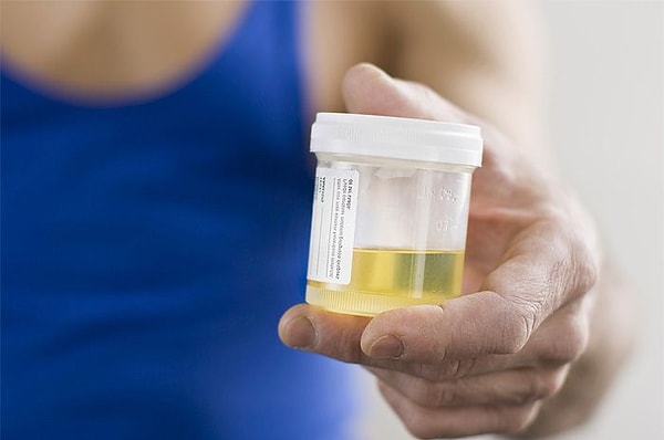 11. Хотя доктора предупреждают, что пользы от уринотерапии нет никакой, и люди, пьющие мочу, лишь издеваются над собой и своим организмом.