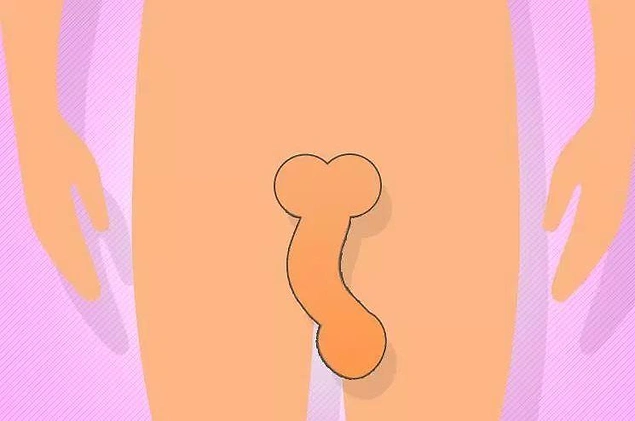 cum să alegi un inel de penis bărbații au erecție matinală