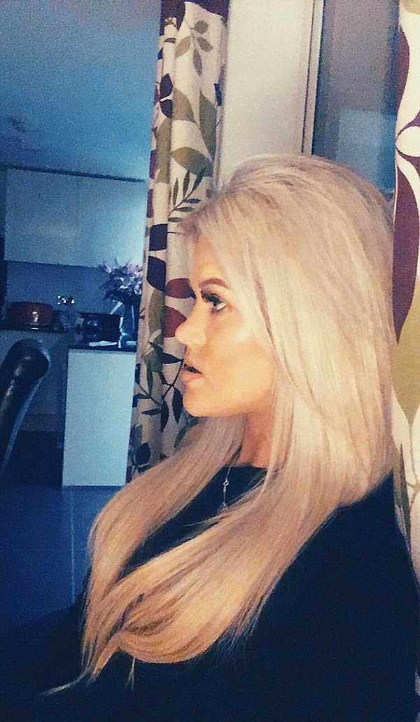 Вот как выглядела Лулу до операции