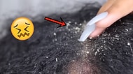 Sivilce Patlatma Videolarından Sonra Yeni Trend: Kafa Derisindeki Kepekleri Soymak