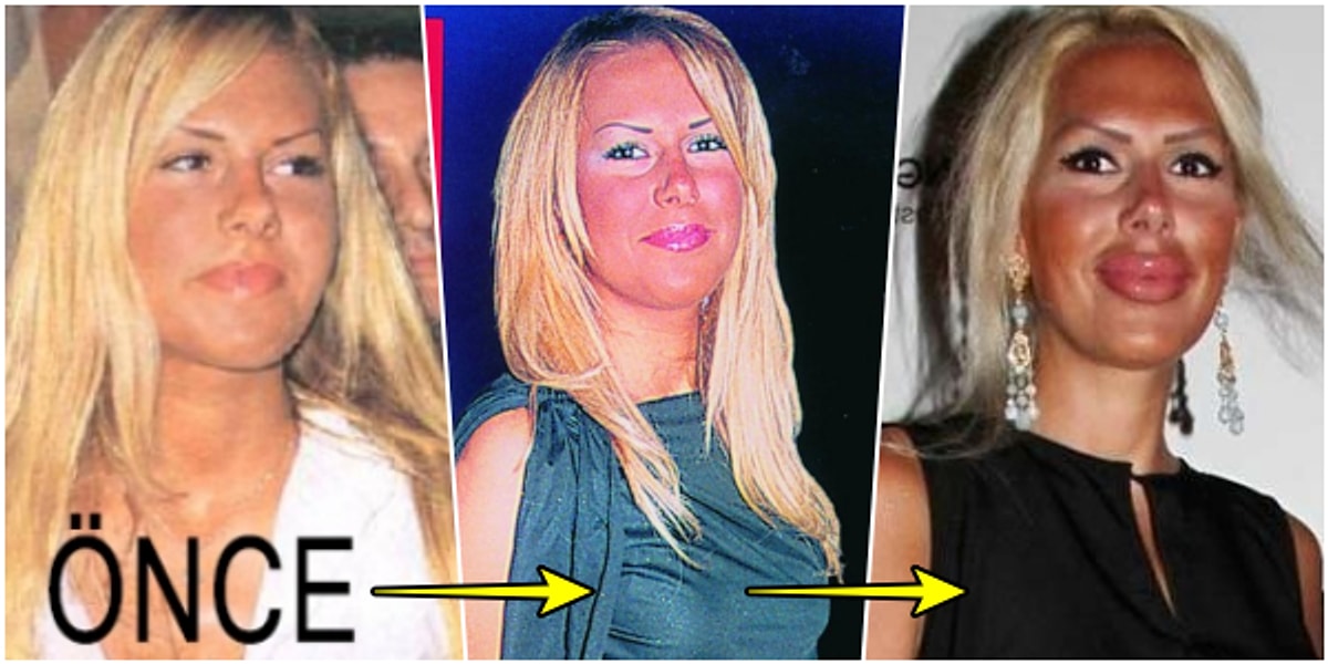 Sadece Dudaklarimda Estetik Var Diyen Sosyetenin En Unlu Kadini Hande Acar In Gecmisten Gunumuze Soke Eden Evrimi Sadece Dudaklarimda Estetik Var Diyen Sosyetenin En Unlu Kadini Hande Acar In Gecmisten Gunumuze Soke Eden Evrimi