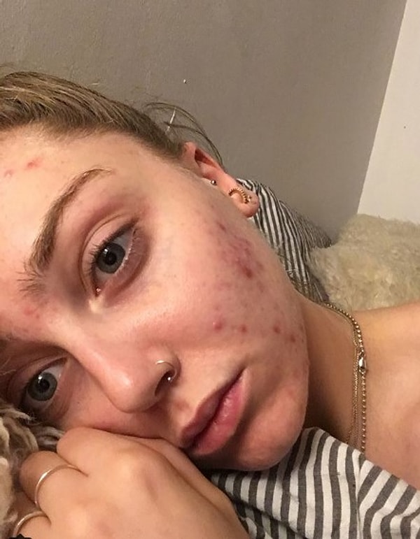 8. Луиза Норткоут