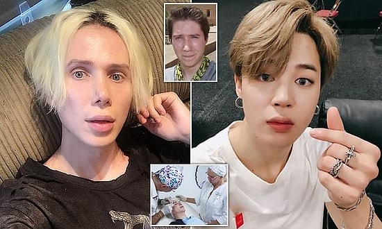 Британец потратил более 6,5 млн рублей и чуть не ослеп, пытаясь стать похожим на корейскую поп-звезду