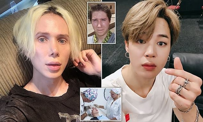 Британец потратил более 6,5 млн рублей и чуть не ослеп, пытаясь стать похожим на корейскую поп-звезду