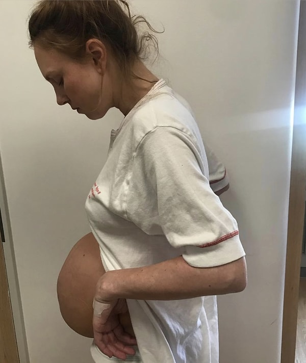 5. ... а еще Мария делится со своими подписчиками реалиями послеродового периода женщины, давшей жизнь сразу трем малышам.