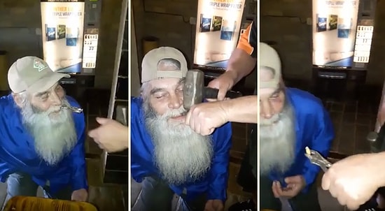 Dişini Çektirirken Pense ve Çekiçten Yardım Alan Rahatsız Adam