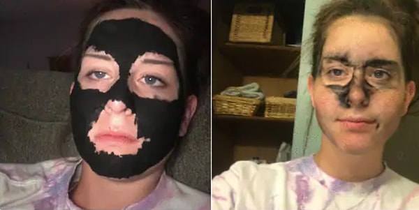 9. "Не ходи к косметологу", - говорили они... "Сделай маску дома", - говорили они...