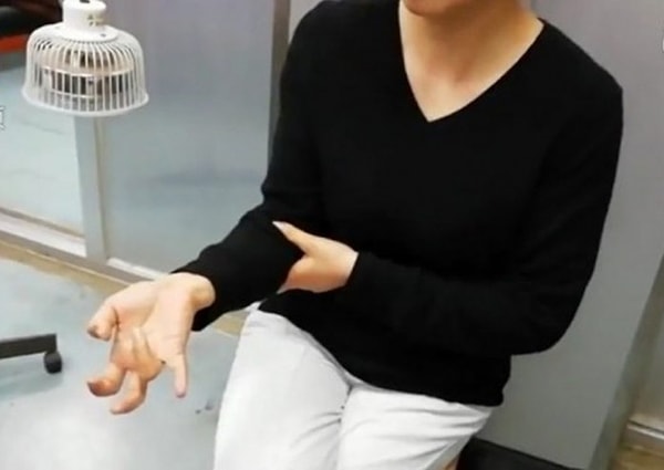 Позднее девушка призналась врачу, что отвлекалась от телефона только на время сна.