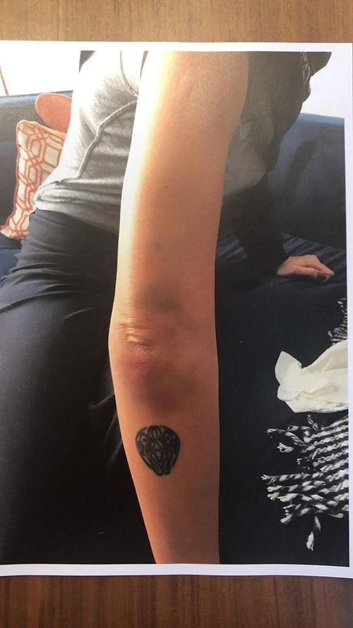 Ünlü müzisyen kollarındaki morlukları gösteren fotoğrafları da delil olarak sunmuştu.