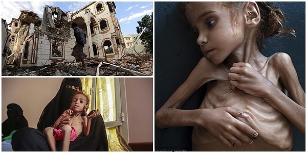 ÃÂÃÂ°ÃÂÃÂÃÂ¸ÃÂ½ÃÂºÃÂ¸ ÃÂ¿ÃÂ¾ ÃÂ·ÃÂ°ÃÂ¿ÃÂÃÂ¾ÃÂÃÂ "ÃÂocuklara KÃÂ±ymayÃÂ±n Efendiler": 7 YaÃÂÃÂ±ndaki ÃÂocuÃÂun AÃÂ§lÃÂ±ktan ÃÂlmesi Yemen'de YaÃÂanan ÃÂ°nsanlÃÂ±k DramÃÂ±na IÃÂÃÂ±k Tuttu!