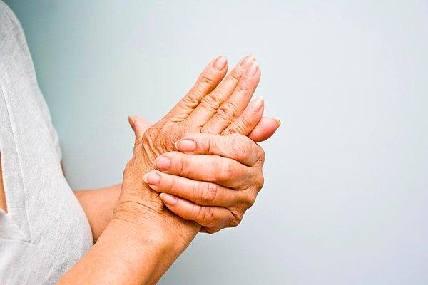 9. Romatoid artrit