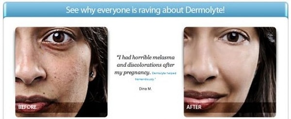 Она рекламировала крем от мешков под глазами, была лицом фирмы, занимающейся подготовки виз в Уругвай и Канаду...