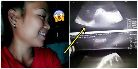 17 Yaşındaki Kızlarının Balıktan Hamile Kaldığını Düşünen Filipinli Aile!